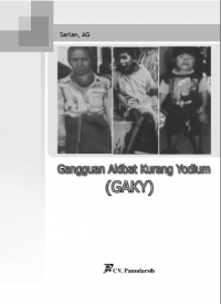 Gangguan Akibat Kurang Yodium